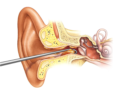 Ear Diagram